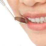 close-up-woman-dental-checkup_1232-217