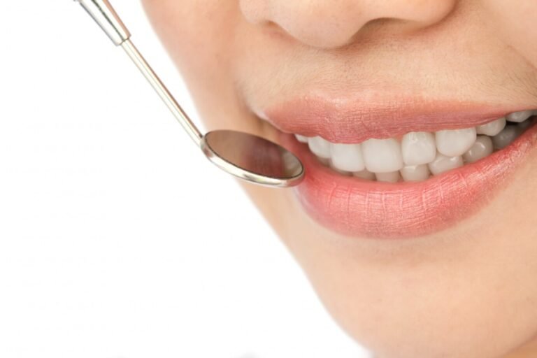 close-up-woman-dental-checkup_1232-217